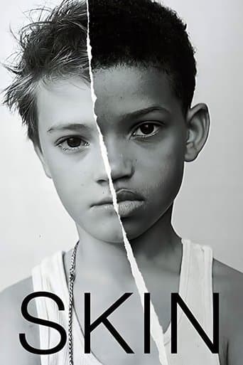 Watch Skin free online