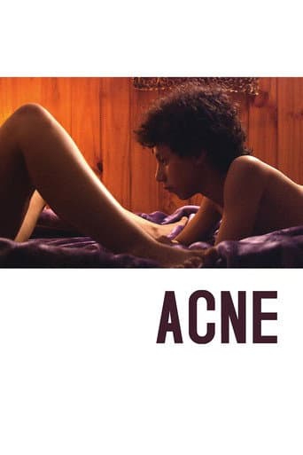 Watch Acne free online