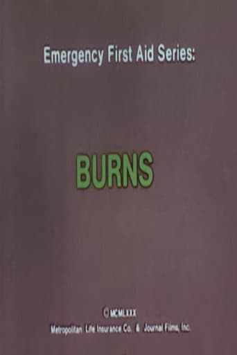 Watch Emergency First Aid Series: Burns free online