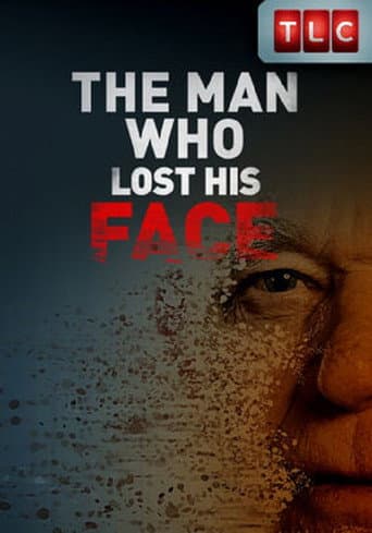 Watch The Man Who Lost His Face free online