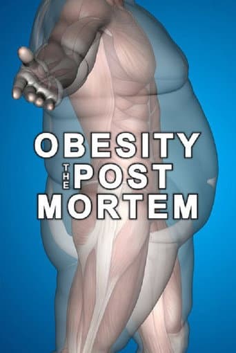 Watch Obesity: The Post Mortem free online